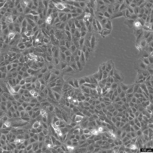 A549/Firefly Luciferase Cell Line - Image 1