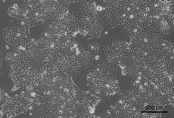 HCT 116/Firefly Luciferase Cell Line - Image 1
